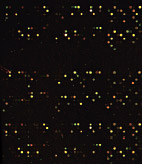 Comparison of microRNA