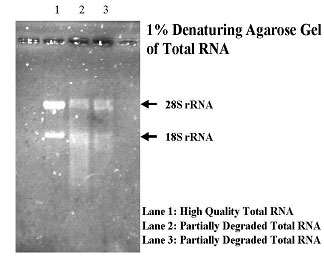 Interpreting Gel Results